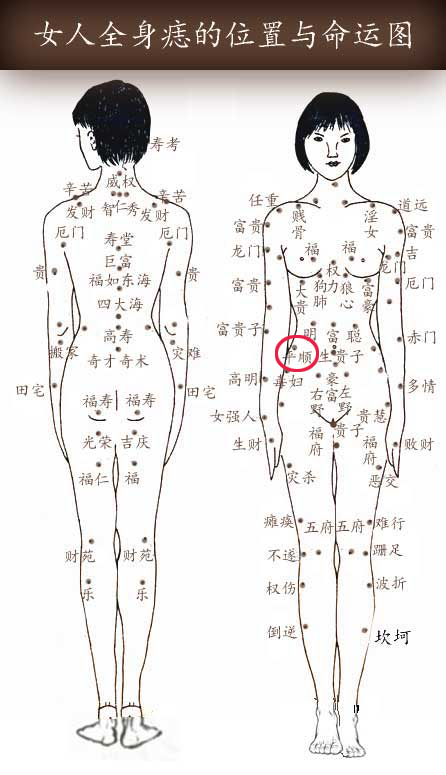 平顺痣 平顺痣